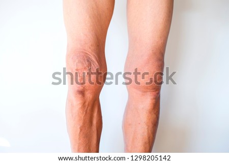 Health Care  Medical,Old man's legs on a white background Royalty-Free Stock Photo #1298205142