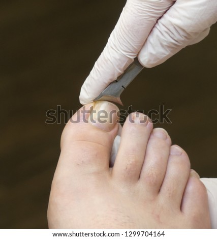 Podiatrist Podiatry Foot Care Podologia Podologe Chripodist