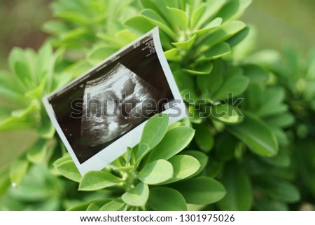 Result of ultrasound picture or ultrasonography for pregnancy on top of green leaf