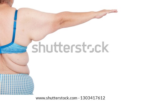 Middle aged woman with sagging excess arm skin after extreme weight loss. Before brachioplasty, panniculectomy, abdominoplasty and mummy makeover. Back view full right arm. Royalty-Free Stock Photo #1303417612
