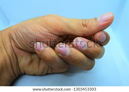 Hands and fingers of various shapes