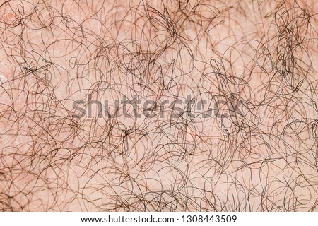 Body hair close-up. Hairy background. Fragment of human hair covering the pink skin.