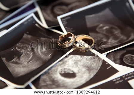 Wedding rings on the background of ultrasound