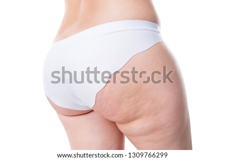 Overweight woman with fat legs and buttocks, obesity female body isolated on white background, studio shot