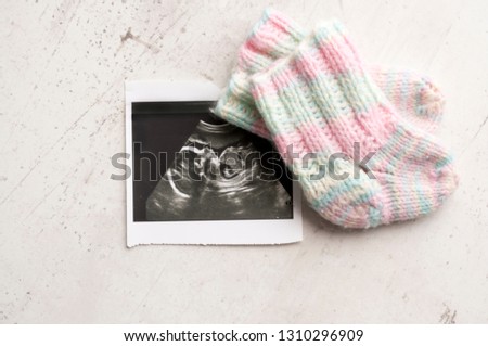Knitted pink socks for the child DIY, lying on the picture ultrasound. Waiting for the child, pregnancy. Selective focus