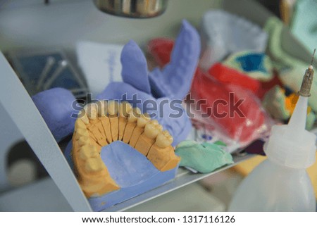 Plaster model of the upper and lower jaw of the patient of dental clinic fixed on the stand, tripod, for tests