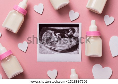 Baby scan ultrasound picture. Expectant parents concept
