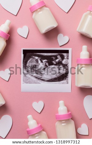 Baby scan ultrasound picture. Expectant parents concept