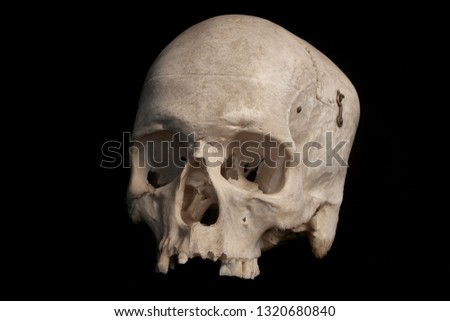 Human skull against a black background at 210 degrees.