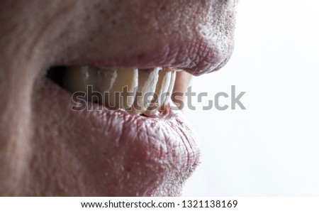 patient before dental treatment