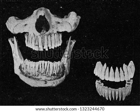 Human teeth on the jaw and the two rows of isolated teeth, vintage photo. From the Universe and Humanity, 1910.
