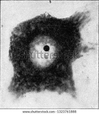 Nerve cell with its nucleus and a small corpuscle nucleus very strongly enlarged, vvintage photo. From the Universe and Humanity, 1910.
