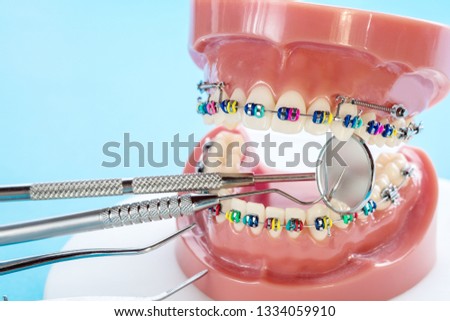 Close up dentist tools and orthodontic model  - demonstration teeth model of varities of orthodontic bracket or brace