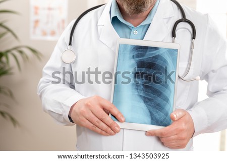 Male doctor showing a digital x-ray image on a tablet