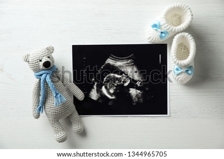 Ultrasound photo of baby, toy and knitted boots on wooden background, flat lay