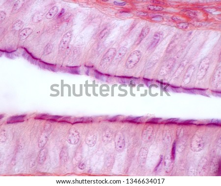 High magnification micrograph showing the simple columnar ciliated epithelium of a fallopian tube. Cilia and basal bodies are stained blue. There are also some non-ciliated cells. Mallory PTAH stain. Royalty-Free Stock Photo #1346634017