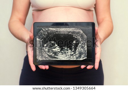 Pregnant woman shows a picture of a baby ultrasound scan on a tablet.  