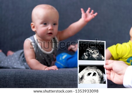 A picture of an ultrasound of pregnancy with twins for 20 and 4 weeks in the foreground in focus. Gemini boy and girl in the background out of focus. Concept of growth and development of the child