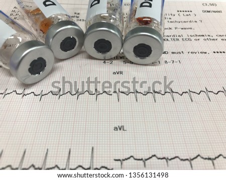 Drug bottle on the ECG effect in patients with tachycardia.