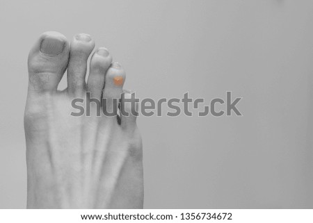 Close up a toes with red swelling Royalty-Free Stock Photo #1356734672