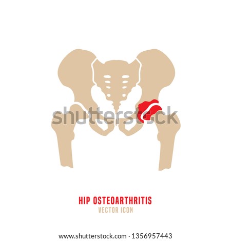 Hip Osteoarthritis Icon. Flat style. Lower back and joint pain. Editable vector illustration isolated on a white background. Medical, healthcare, elderly diseases graphic concept.