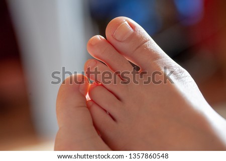 young girl's toes are healthy and beautiful. Well-groomed toes. Concept for medical articles and ointments - the image of the toes and feet. Image of legs with space for inscriptions and advertising. Royalty-Free Stock Photo #1357860548