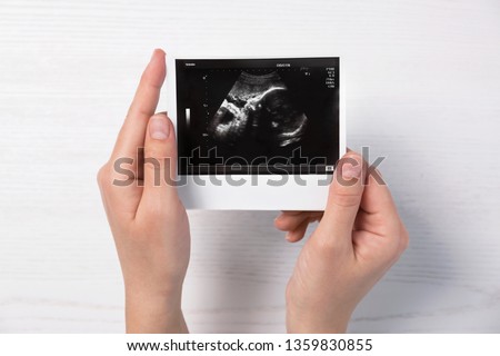 Woman holding ultrasound photo of baby over table, top view Royalty-Free Stock Photo #1359830855
