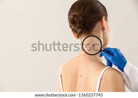 Dermatologist examining moles of patient on light background Royalty-Free Stock Photo #1360237745