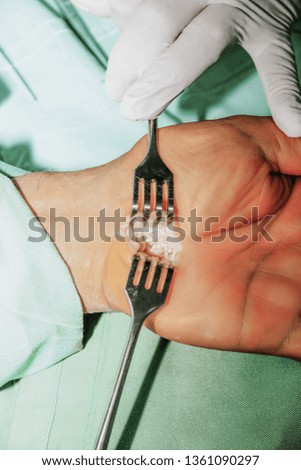 Male adult hand surgery in hospital