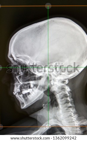 A screen shows the cranial radiograph of a patient.