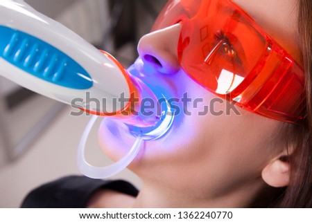 Teeth whitening process with ultraviolet UV light. Royalty-Free Stock Photo #1362240770