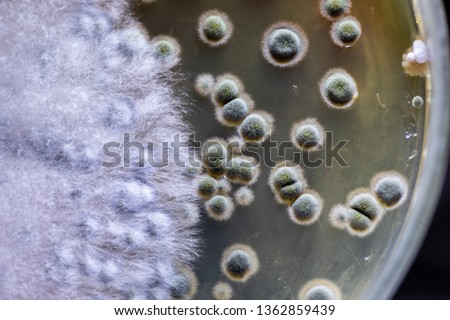 Colony characteristic of Actinomyces, Bacteria, yeast and Mold on selective media from soil samples for study in laboratory microbiology.
