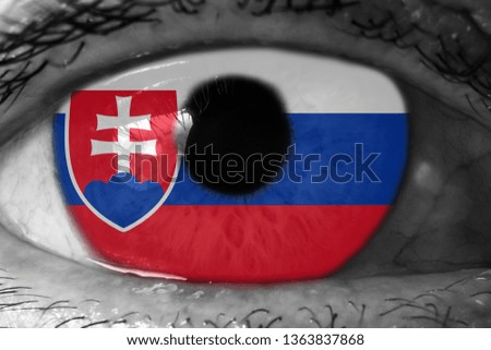 Slovakia flag in the eye