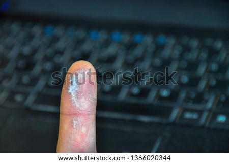 Detail of finger covered by dust from a black dusty laptop keyboard. Computer keyboard as a background. 