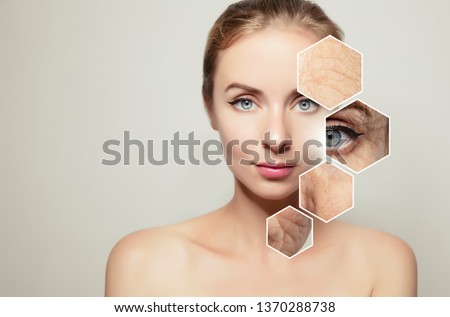 woman portrait with closeup textured elements with old problem skin. Template for beauty product design Royalty-Free Stock Photo #1370288738