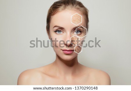 woman face portrait with graphic elements showing old problem skin Royalty-Free Stock Photo #1370290148