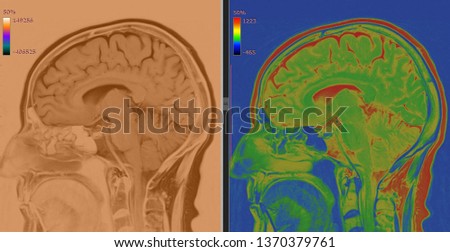 Brain MRI Scan (High Resolution Head Images)