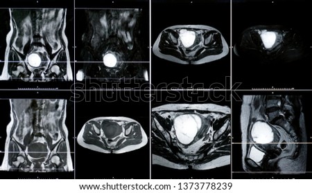 Magnetic Resonance Image (MRI) of human abdomen.            