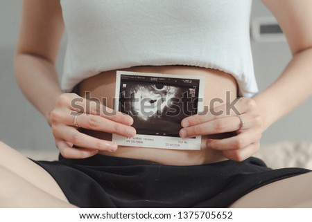 Young pregnant woman looking at 4 Weeks x-ray ultrasound scan of baby
