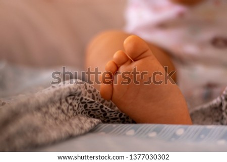 Close up of baby legs and feet, Syndactyly condition on foot toes, Webbed toes