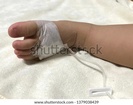 Babies may have an intravenous fluid line at foot patient.