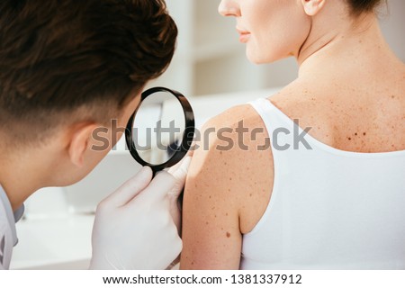 cropped view of dermatologist holding magnifying glass while examining patient with skin disease   Royalty-Free Stock Photo #1381337912