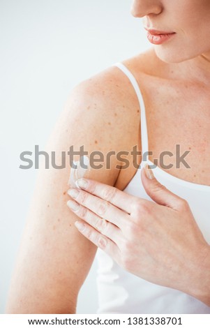 cropped view of sick woman applying cosmetic cream on white 
