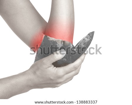 Female holding ice gel pack on elbow. Medical concept photo. Isolation on a white background. Color Enhanced skin with read spot indicating location of the pain.