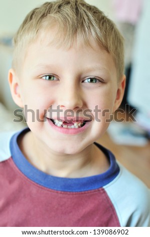 little boy showing that he lost  milk tooth