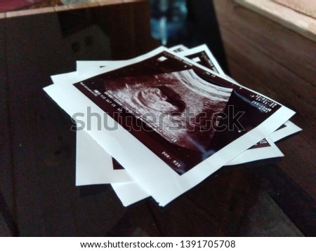 Ultrasound image for pregnancy on dark background. Royalty-Free Stock Photo #1391705708
