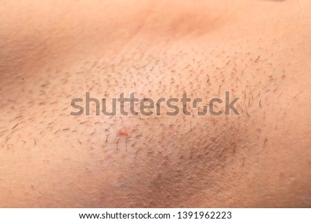 Close up picture of unshaved armpit, hair growing on human skin