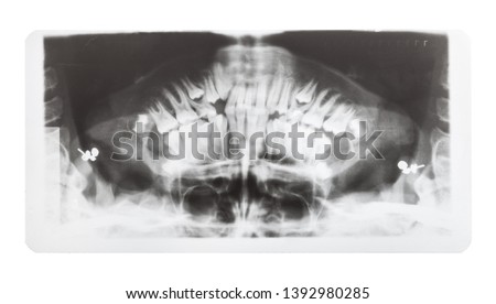 film with X-ray image of human jaws isolated on white background