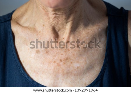 Neck of old senior citizen woman Royalty-Free Stock Photo #1392991964