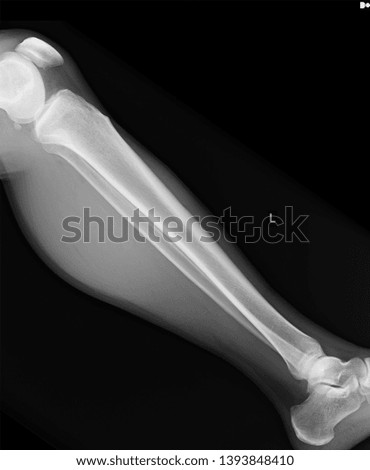 X-ray picture of body part